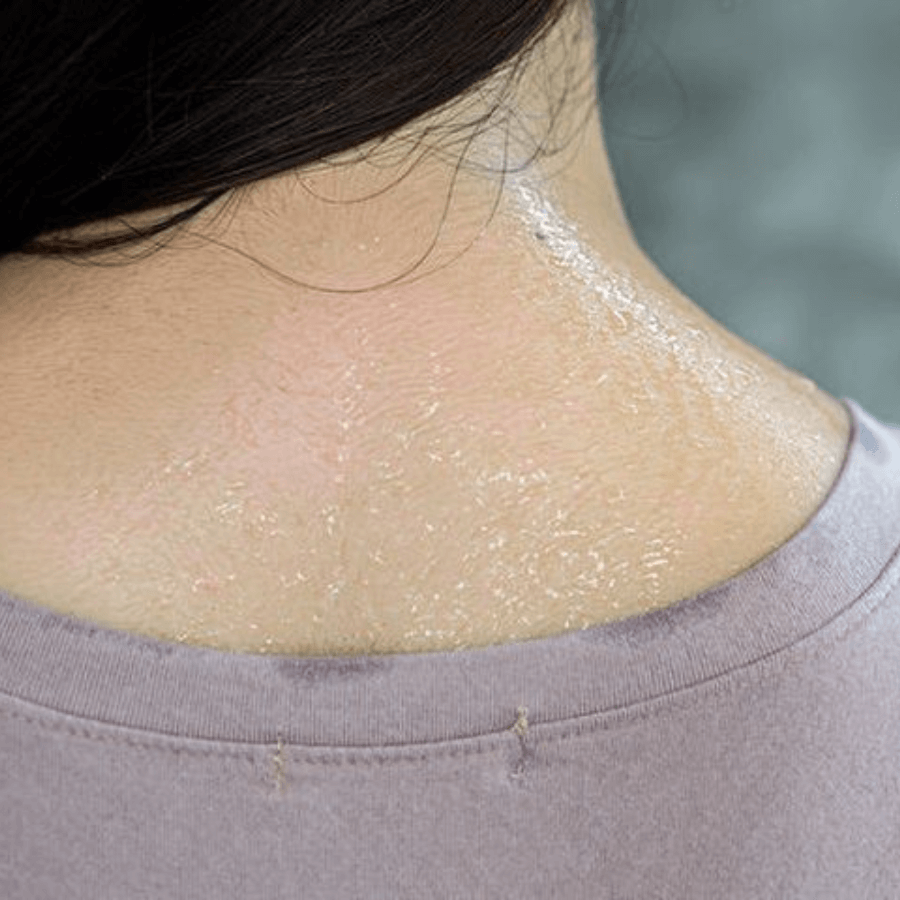 nệm cho người hay đổ mồ hôi lưng